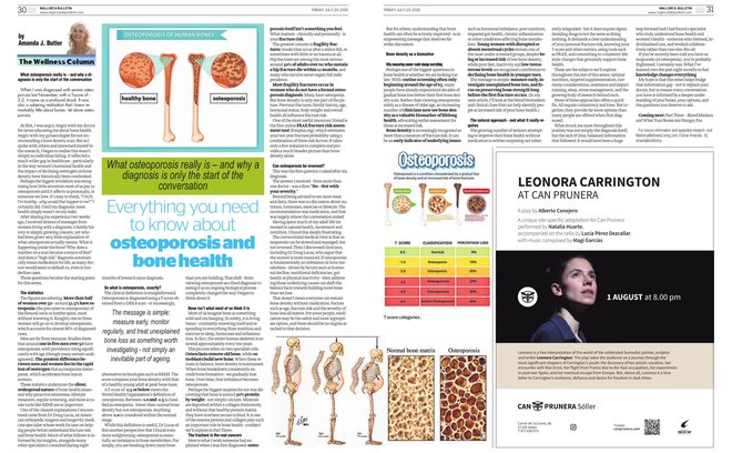 Amanda J Butler's Wellness Column in the Mallorca Bulletin: What Is Osteoporosis? Everything You Need to Know About Bone Health, Diagnosis and Your Options