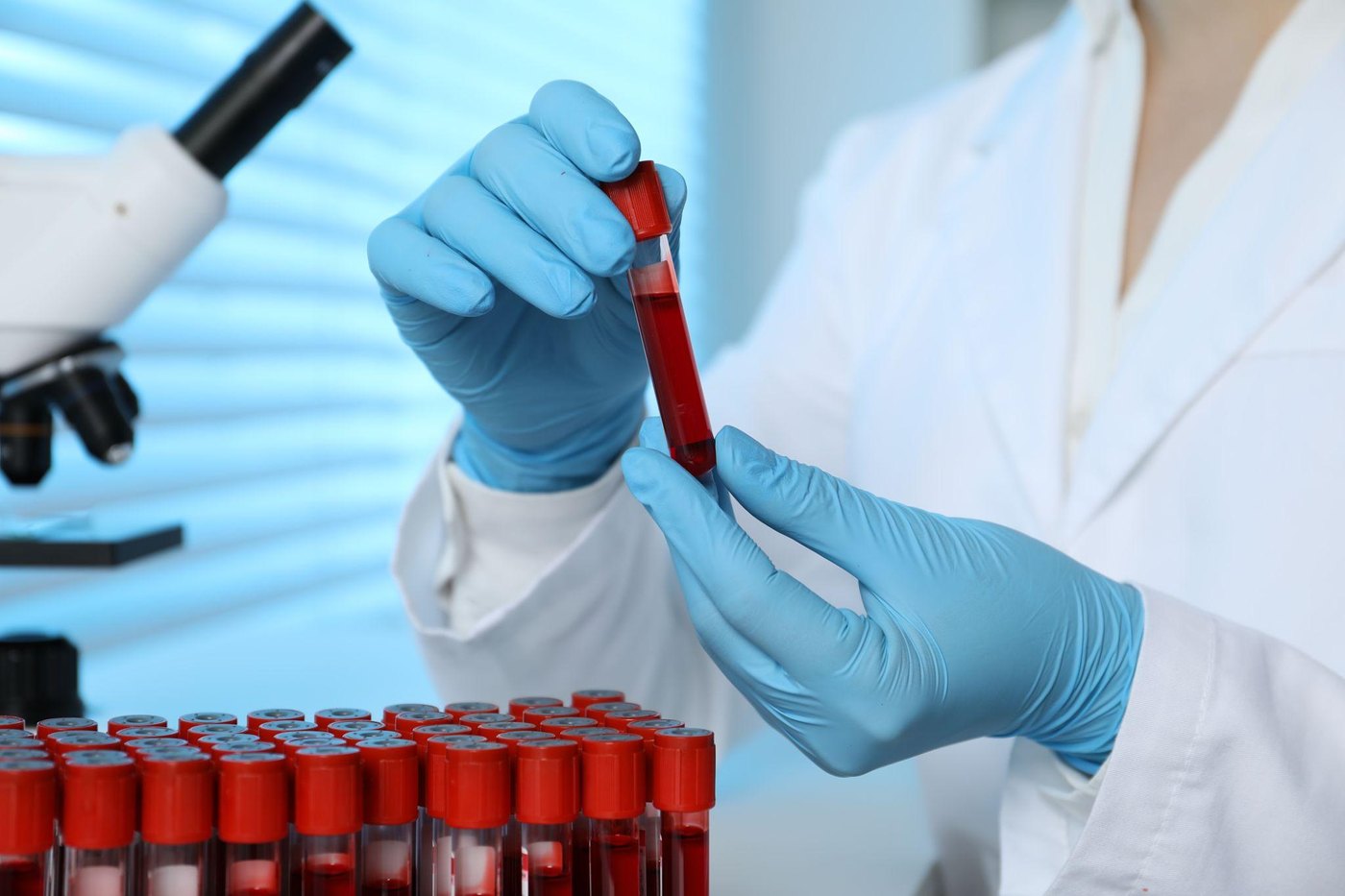 Laboratory technician holding a blood sample for bone turnover marker testing